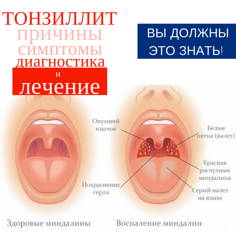 Двигатель nissan hr16de h4m